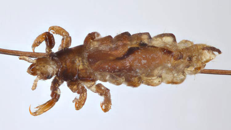 Nahaufnahme Kopflaus